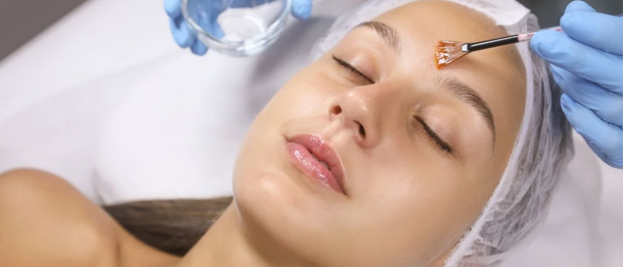 TCA peel( Dark underarms)